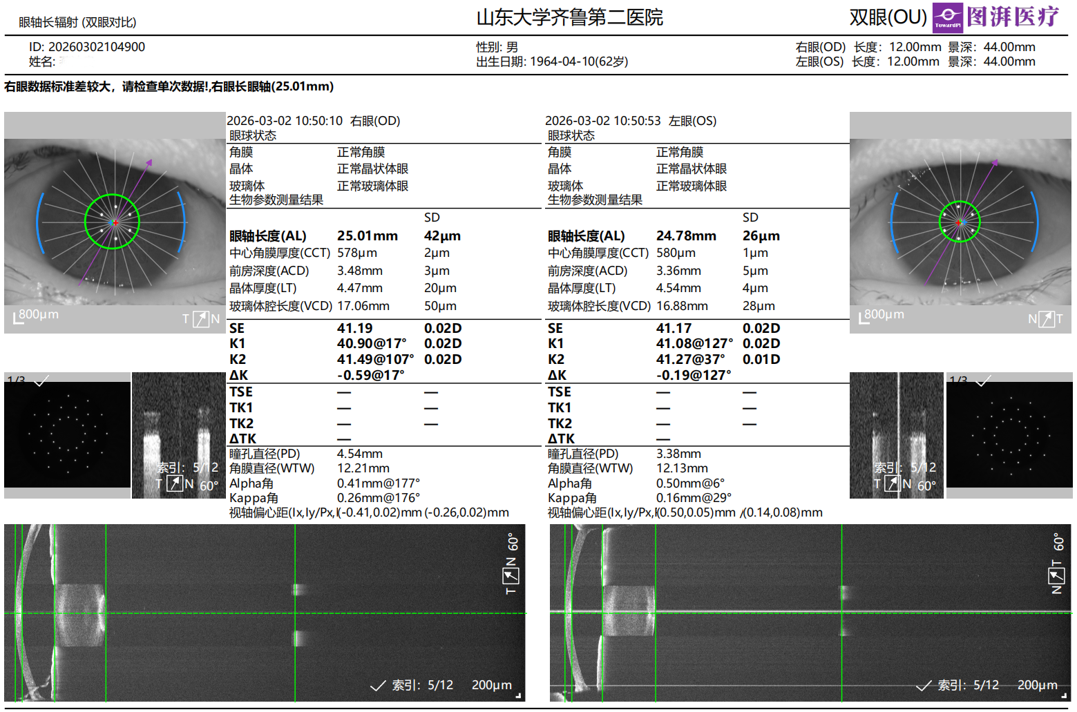 One-Stop Planning for Refractive Cataract Surgery 3.png