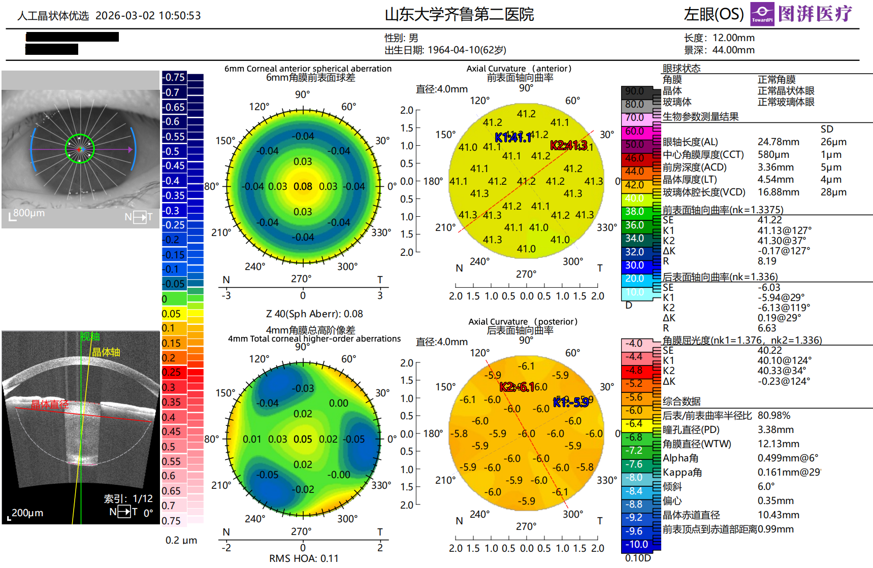 One-Stop Planning for Refractive Cataract Surgery 5.png