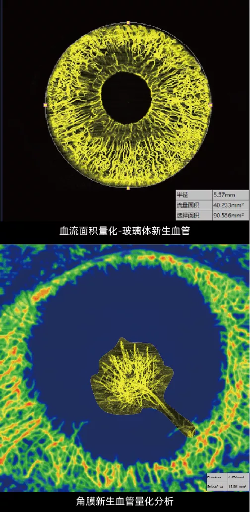 前节OCTA量化分析
