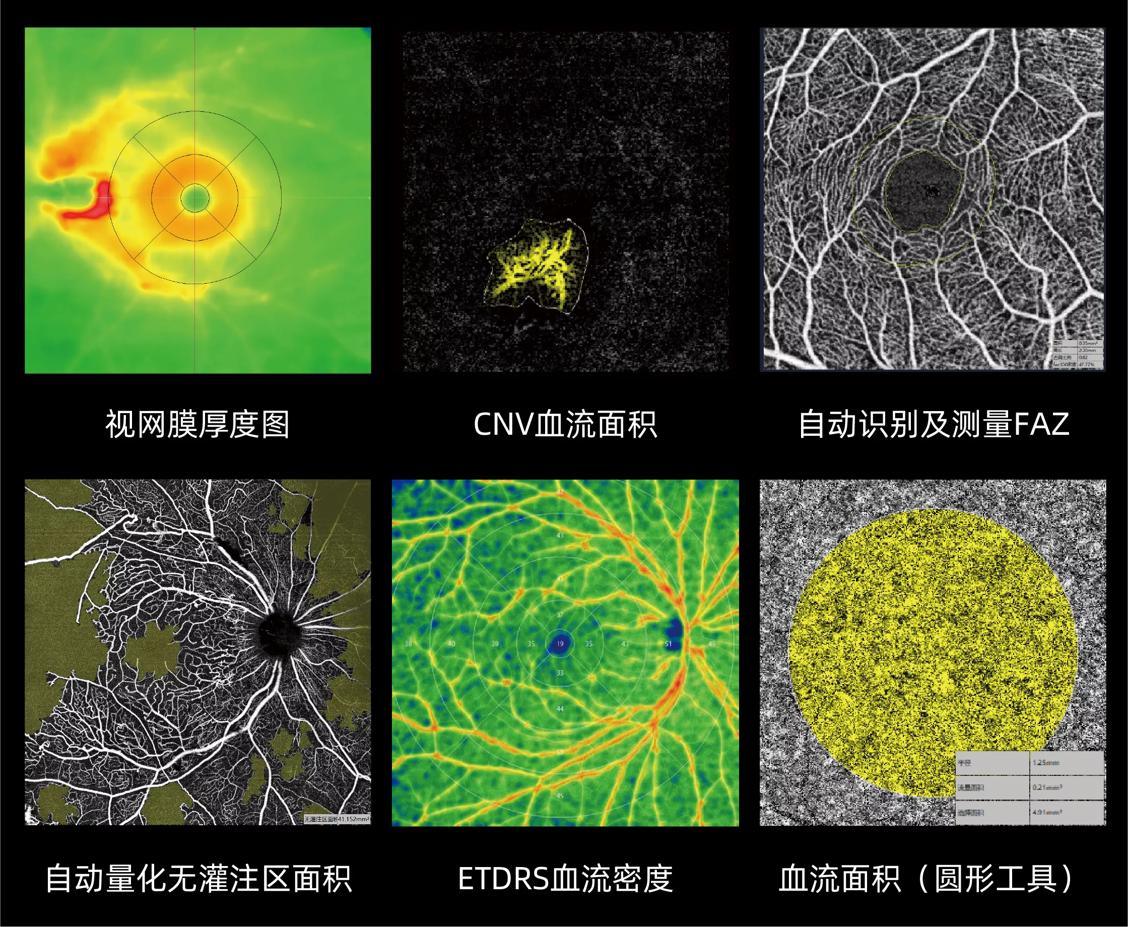OCT与OCTA量化分析功能