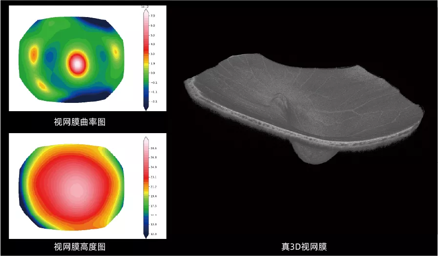 视网膜形态三联