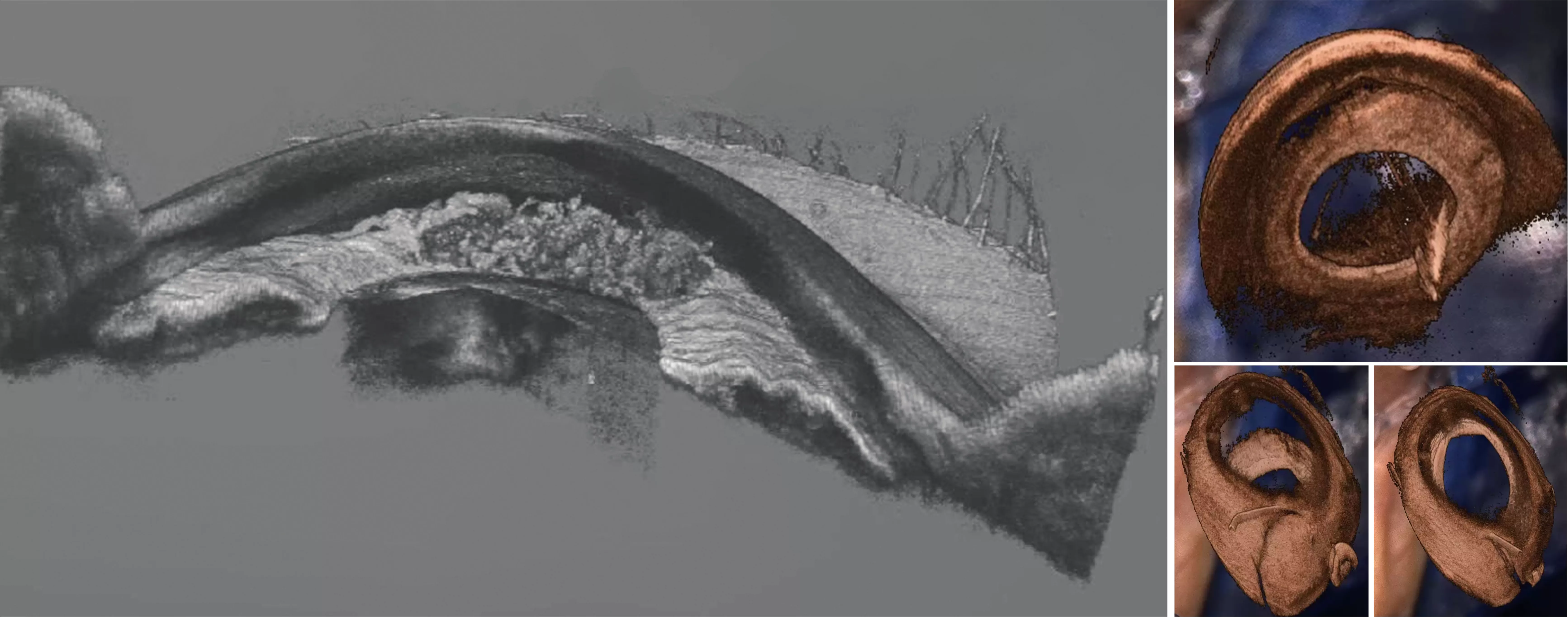4D实时全息透视