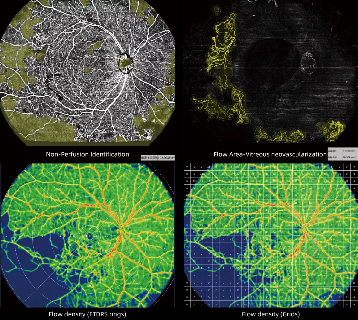 Blood flow with quantification