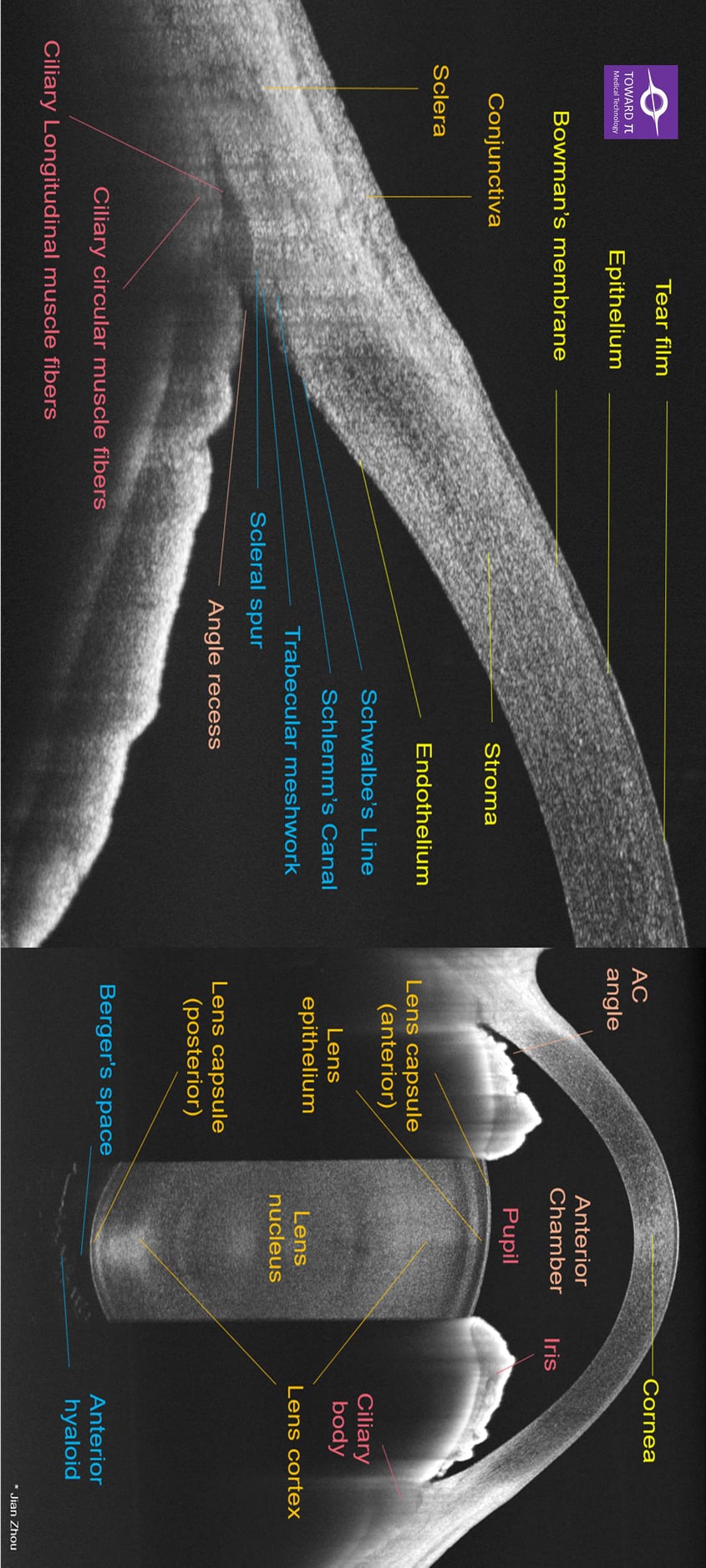 Diagram of Anterior Segment OCT: Cornea, AC, Lens, etc - TowardPi Medical