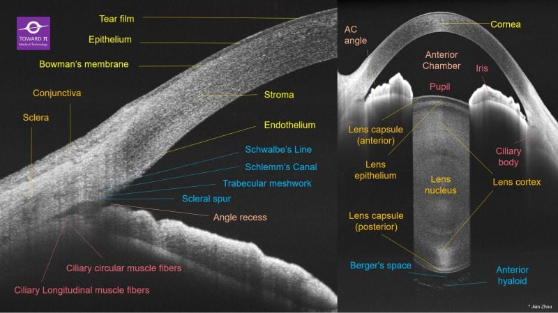 Diagram of Anterior Segment OCT: Cornea, AC, Lens, etc - TowardPi Medical