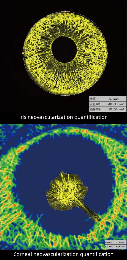 AS OCTA quantifications