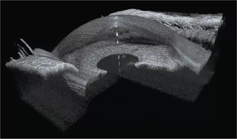3D Reconstruction of AS