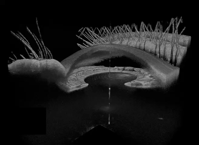 360° 3D Panaromic anterior segment