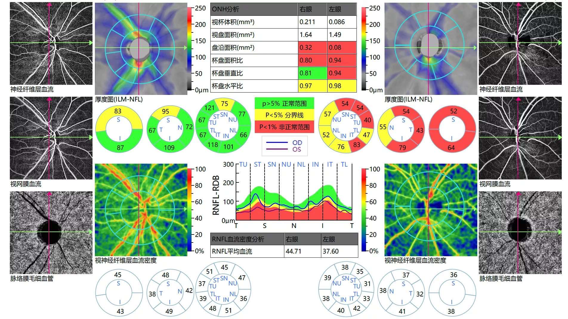 OU Optic disc flow and glaucoma analysis