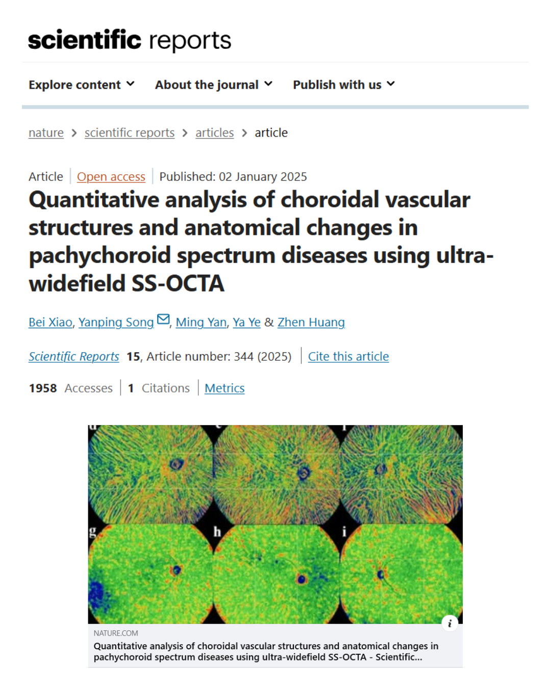 Insights into choroidal vascular changes in pachychoroid spectrum diseases using UWF SS-OCTA_TowrdPi publication in Nature.png