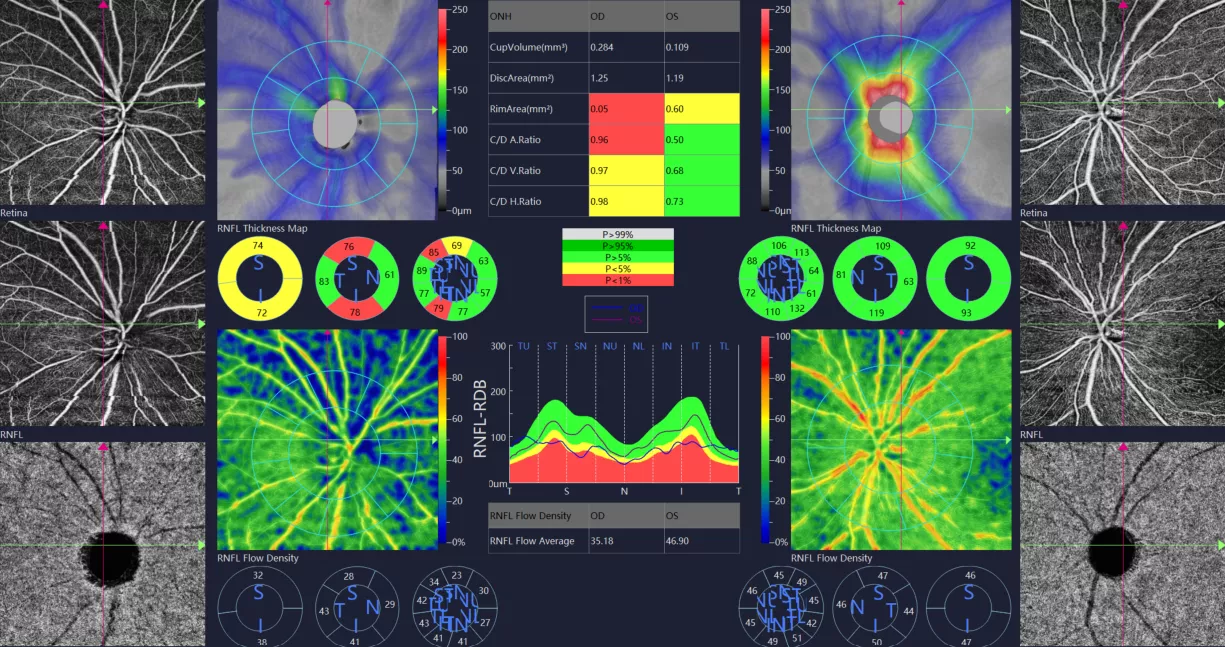 ONH analysis (structure & flow)